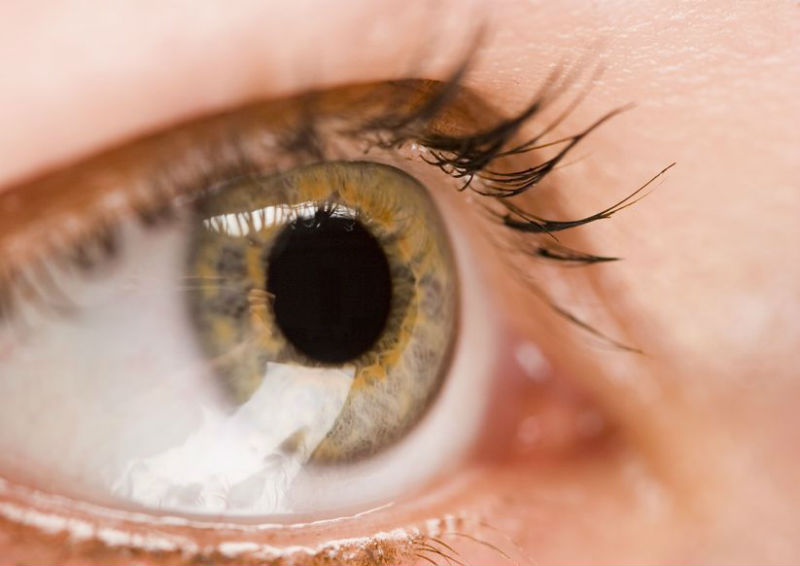 Do You Need Lasik Eye Surgery In Dearborn MI?